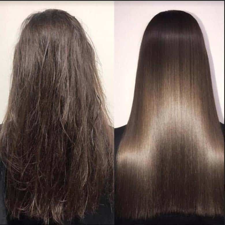 Nanoplasty result in Belfast & Carrickfergus