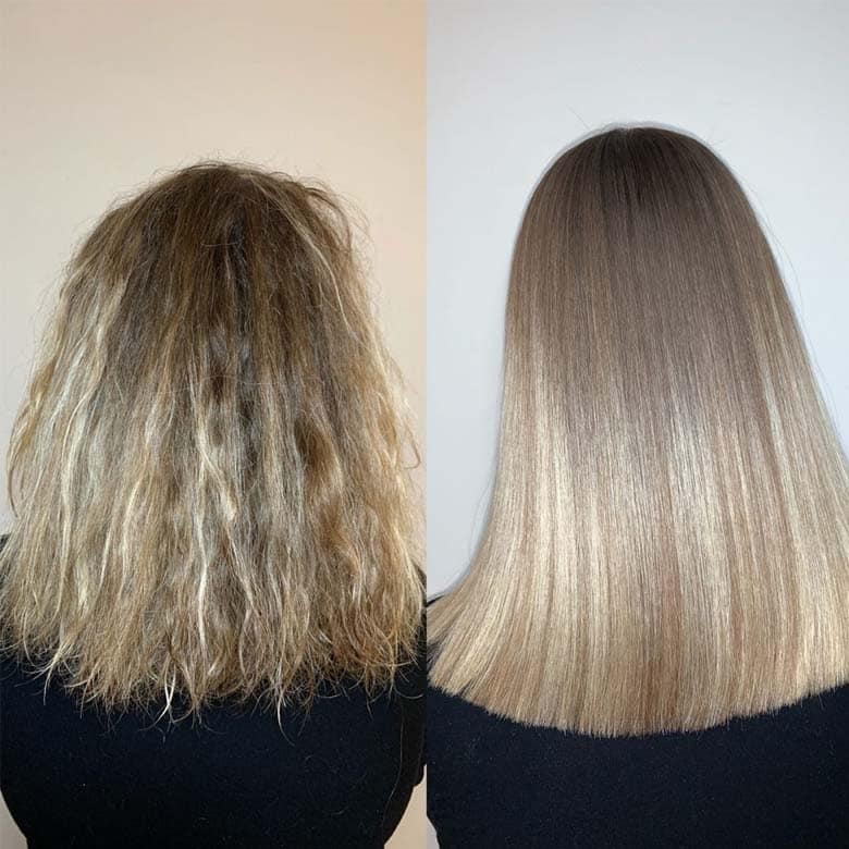 Nanoplasty result in Belfast & Carrickfergus