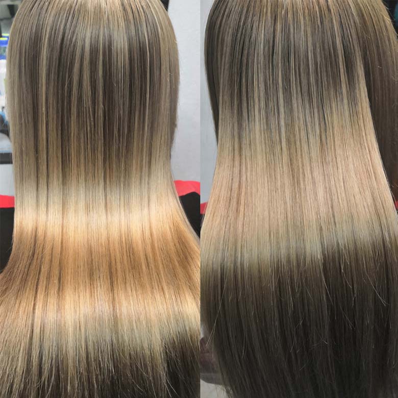Nanoplasty result in Belfast & Carrickfergus