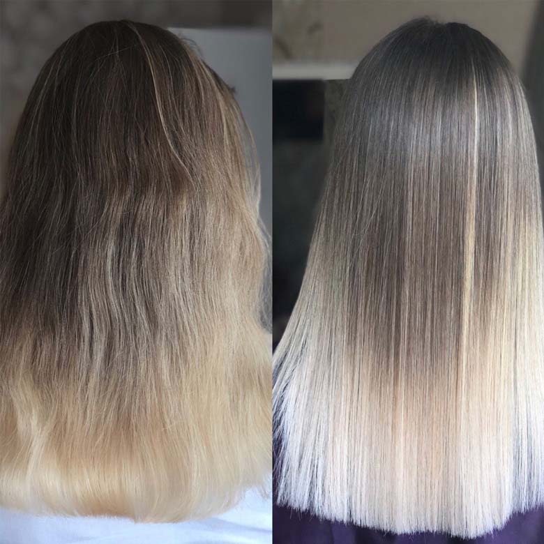 Nanoplasty result in Belfast & Carrickfergus