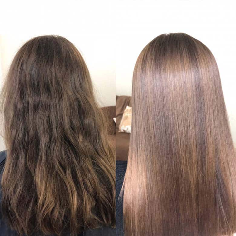 Nanoplasty result in Belfast & Carrickfergus